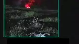 هزاز الثدي الجيش